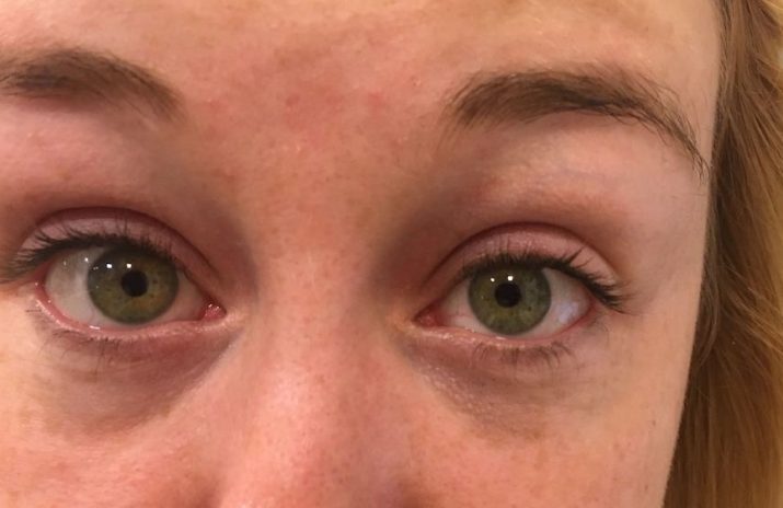 Is Vision Insurance Worth It? A Not-So-Clear Choice Is Vision Insurance Worth It? A Not-So-Clear Choice | Photo of woman's green eyes | Photo by Evan Sachs