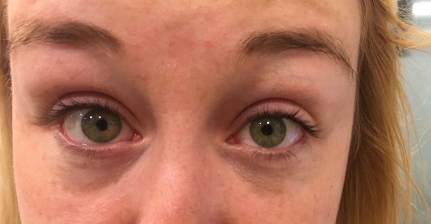 Is Vision Insurance Worth It? A Not-So-Clear Choice